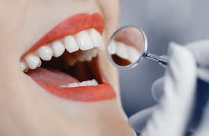 Best Cosmetic Dentistry Melbourne